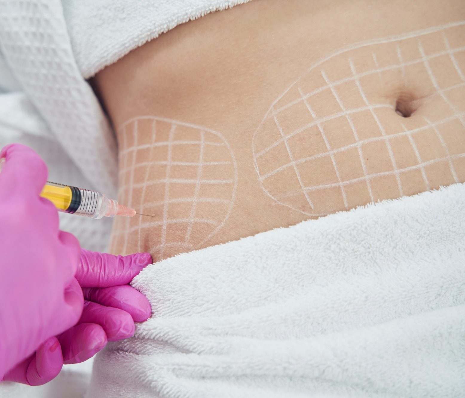 Dermatologist performing non invasive fat reduction procedure in beauty center